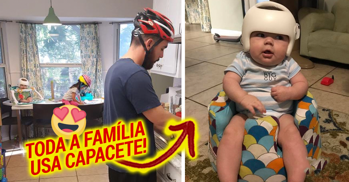 Este bebé teve que usar um capacete e a família juntou-se à causa