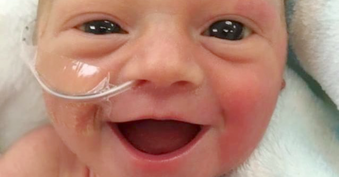 Bebé prematura sorri de orelha a orelha com 5 dias de idade