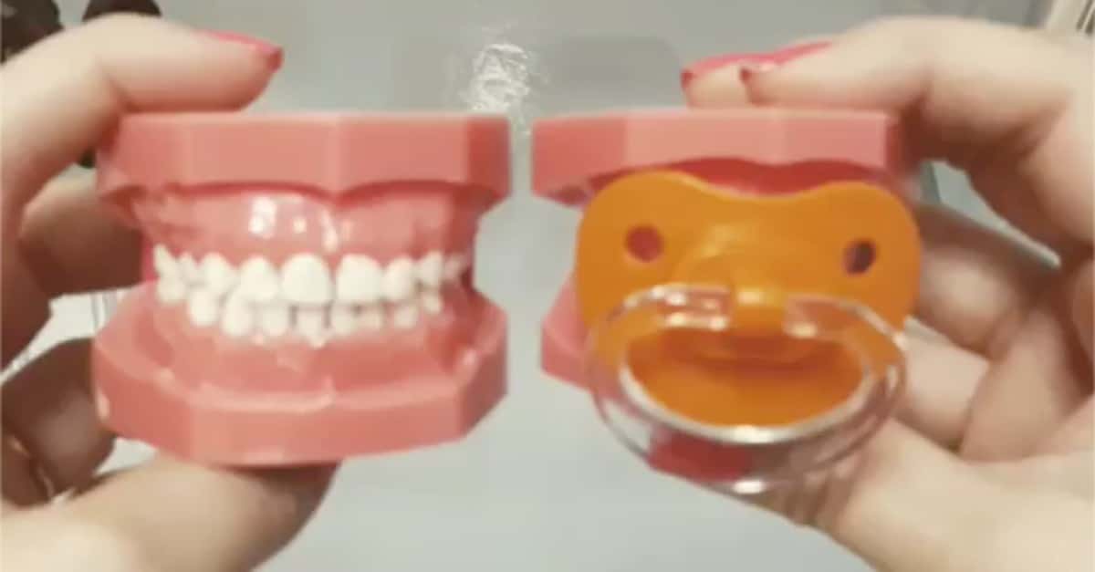 O efeito das chupetas nos dentes das crianças