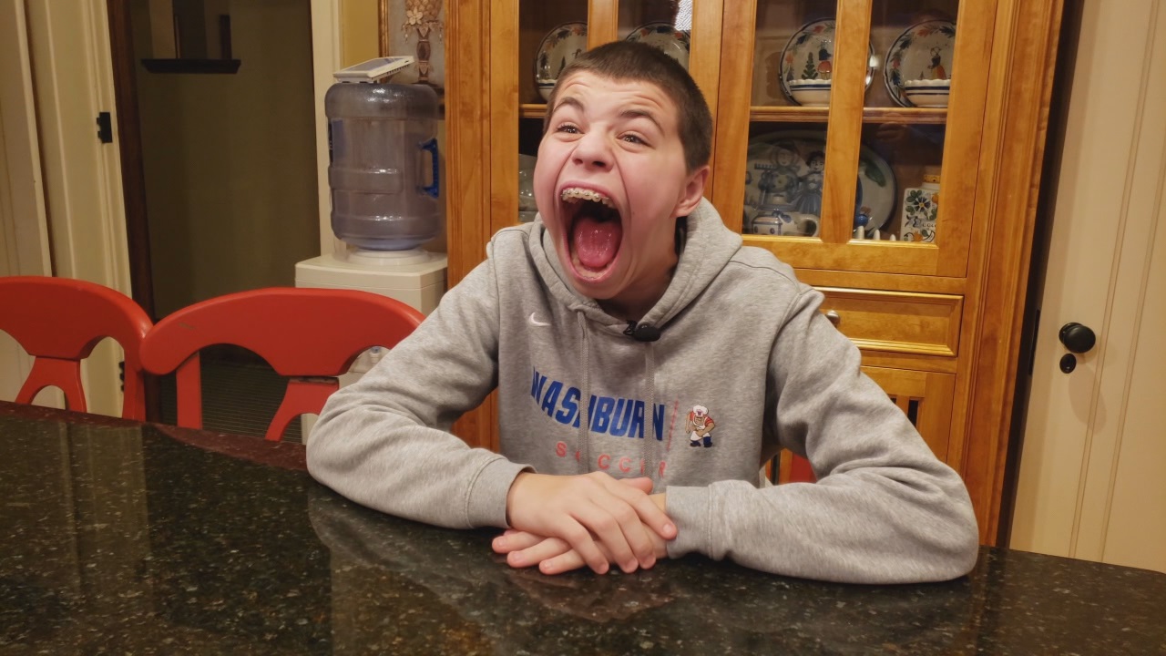 Jovem de 14 anos entra para o Guinness com a maior boca do mundo