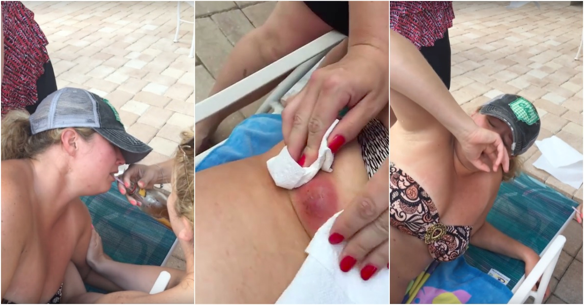 Espremeram uma BORBULHA GIGANTE a amiga e o resultado é ASSUSTADOR