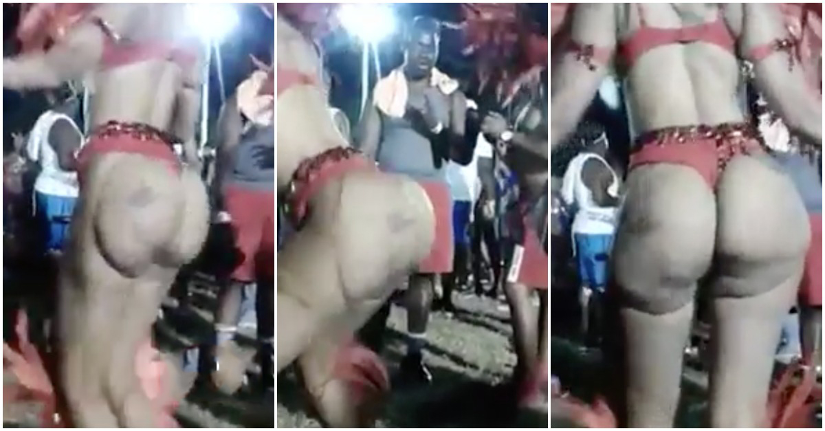 Quando colocas implantes nas nádegas e o trabalho parece ter sido feito por um calceteiro