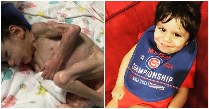 Mãe comove o mundo ao mostrar a recuperação de criança que adotou à beira da morte