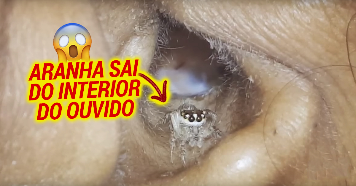 Aranha sai contente da vida do interior do ouvido de uma mulher