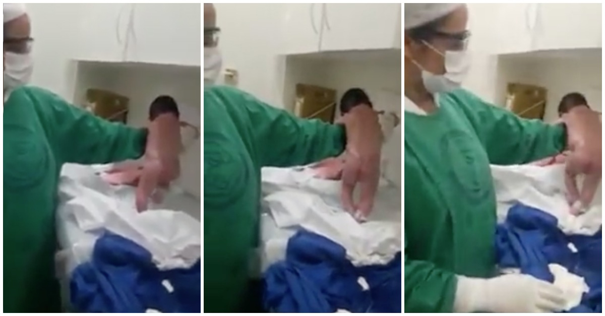 Bebé recém-nascido tenta andar logo após o parto e deixa médicos incrédulos