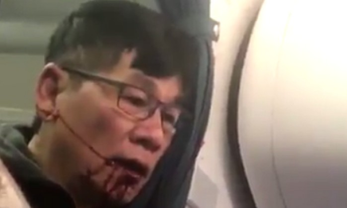 Passageiro da United Airlines é retirado à força do avião